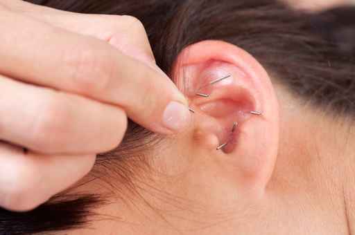 Détail d'acupuncture dans l'oreille