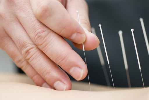 Cette Image Présente Une Figure D'acupuncture, Un Outil Essentiel