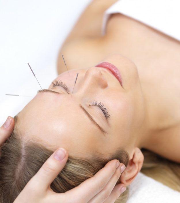 Acupuncture pour le lifting
